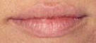 Permanent Cosmetics by Helen -- Before