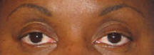 Eyebrows Before Permanent Cosmetics by Helen Seattle Tacoma