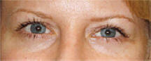 Eyeliner After Permanent Cosmetics by Helen Seattle Tacoma