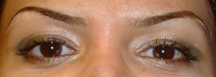 After Permanent Cosmetics by Helen Seattle Tacoma