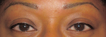 After Permanent Cosmetics by Helen