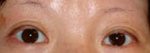Before Permanent Cosmetics by Helen