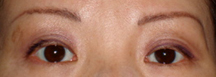 After Permanent Cosmetics by Helen