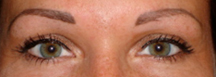 After Permanent Cosmetics by Helen